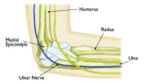 cubital tunnel syndrom